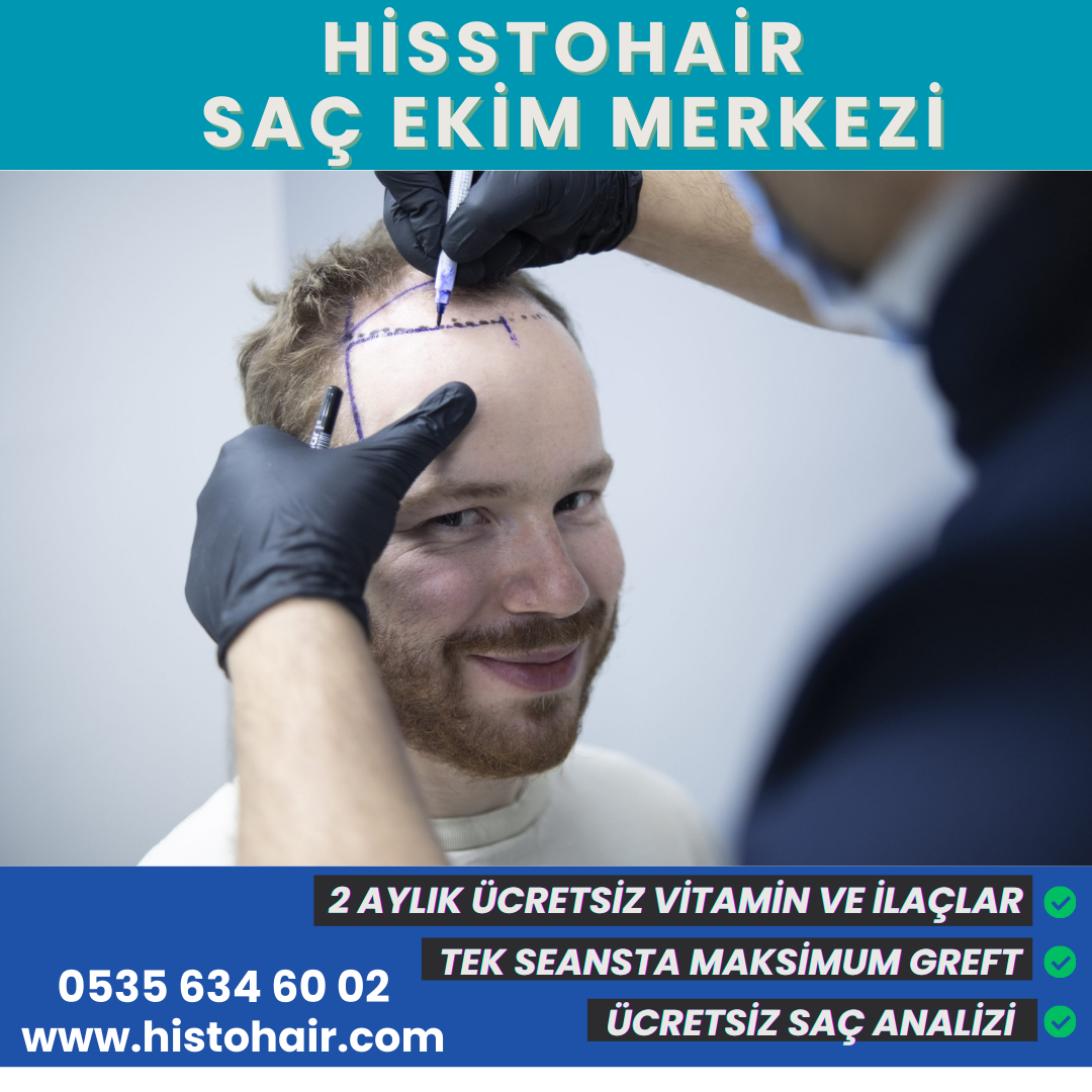 Bayındır Saç Ekim Merkezi